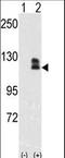 EPH Receptor B2 antibody, LS-C100284, Lifespan Biosciences, Western Blot image 