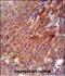 Cocaine esterase antibody, A02868-1, Boster Biological Technology, Immunohistochemistry paraffin image 