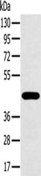MAGE Family Member A10 antibody, CSB-PA216191, Cusabio, Western Blot image 