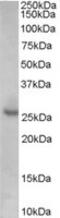 Cyclin Dependent Kinase Inhibitor 1B antibody, MBS421279, MyBioSource, Western Blot image 