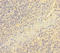 Endothelial cell-selective adhesion molecule antibody, A55335-100, Epigentek, Immunohistochemistry paraffin image 
