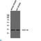 C-Type Lectin Domain Containing 11A antibody, LS-C813503, Lifespan Biosciences, Western Blot image 