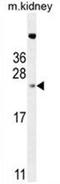 2-Aminoethanethiol Dioxygenase antibody, AP50095PU-N, Origene, Western Blot image 