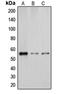 Cytochrome P450 Family 2 Subfamily D Member 6 antibody, orb213824, Biorbyt, Western Blot image 