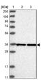 Exosome Component 7 antibody, PA5-57562, Invitrogen Antibodies, Western Blot image 