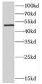 CDP-Diacylglycerol Synthase 2 antibody, FNab01570, FineTest, Western Blot image 
