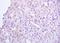 Cytotoxic T-Lymphocyte Associated Protein 4 antibody, orb156486, Biorbyt, Immunohistochemistry paraffin image 