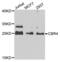 Carbonyl Reductase 4 antibody, PA5-76181, Invitrogen Antibodies, Western Blot image 