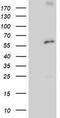 Proteasome 26S Subunit, Non-ATPase 3 antibody, TA504303, Origene, Western Blot image 