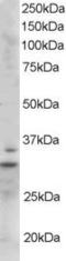 Lck Interacting Transmembrane Adaptor 1 antibody, EB06389, Everest Biotech, Western Blot image 