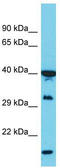 Poly(RC) Binding Protein 1 antibody, TA345949, Origene, Western Blot image 
