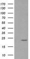 RAB30, Member RAS Oncogene Family antibody, TA505316AM, Origene, Western Blot image 