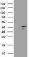 Decapping Enzyme, Scavenger antibody, LS-C174441, Lifespan Biosciences, Western Blot image 