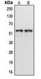 Atlastin GTPase 1 antibody, orb340886, Biorbyt, Western Blot image 
