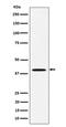 Distal-Less Homeobox 3 antibody, M05844, Boster Biological Technology, Western Blot image 