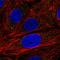 Enhancer Of MRNA Decapping 3 antibody, HPA066137, Atlas Antibodies, Immunofluorescence image 