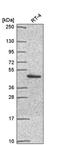 Proteasome 26S Subunit, Non-ATPase 11 antibody, PA5-66921, Invitrogen Antibodies, Western Blot image 