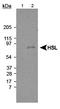 Lipase E, Hormone Sensitive Type antibody, TA336511, Origene, Western Blot image 