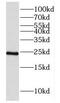 Dihydrouridine Synthase 4 Like antibody, FNab02561, FineTest, Western Blot image 