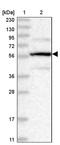 Protein Phosphatase 2 Regulatory Subunit B'Beta antibody, PA5-57740, Invitrogen Antibodies, Western Blot image 