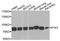 Protein Tyrosine Kinase 7 (Inactive) antibody, A9839, ABclonal Technology, Western Blot image 