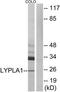 Lysophospholipase 1 antibody, TA312315, Origene, Western Blot image 