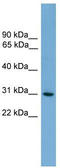 HLA class II histocompatibility antigen, DQ alpha 2 chain antibody, TA331096, Origene, Western Blot image 