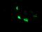 Heme oxygenase 2 antibody, MA5-25750, Invitrogen Antibodies, Immunocytochemistry image 