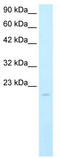 SP140 Nuclear Body Protein antibody, TA331198, Origene, Western Blot image 