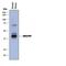 MAS Related GPR Family Member F antibody, MAB8396, R&D Systems, Western Blot image 