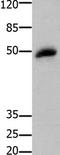 Glycogen Synthase Kinase 3 Beta antibody, TA323060, Origene, Western Blot image 