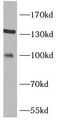 Tripartite Motif Containing 37 antibody, FNab08982, FineTest, Western Blot image 