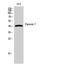 Peroxisomal Biogenesis Factor 7 antibody, A05365-2, Boster Biological Technology, Western Blot image 