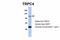 Transient Receptor Potential Cation Channel Subfamily C Member 4 antibody, ARP35256_P050, Aviva Systems Biology, Western Blot image 