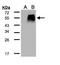 Transforming Growth Factor Beta 1 Induced Transcript 1 antibody, PA5-28839, Invitrogen Antibodies, Western Blot image 