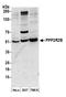 Protein Phosphatase 2 Regulatory Subunit Bbeta antibody, A300-964A, Bethyl Labs, Western Blot image 