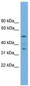 Homeobox protein NOBOX antibody, TA329977, Origene, Western Blot image 