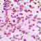 RNA 3'-Terminal Phosphate Cyclase antibody, LS-C353070, Lifespan Biosciences, Immunohistochemistry paraffin image 