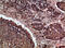 Napsin A Aspartic Peptidase antibody, A05685, Boster Biological Technology, Immunohistochemistry frozen image 