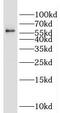 Glyoxylate Reductase 1 Homolog antibody, FNab03516, FineTest, Western Blot image 