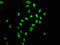 Histone Cluster 1 H2A Family Member E antibody, CSB-RA010385A0HU, Cusabio, Immunofluorescence image 