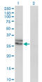 Endothelin-3 antibody, LS-B12661, Lifespan Biosciences, Western Blot image 