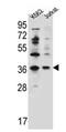Putative protein phosphatase 1 regulatory inhibitor subunit 3G antibody, AP53418PU-N, Origene, Western Blot image 