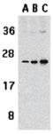 TNF Superfamily Member 13 antibody, GTX31268, GeneTex, Western Blot image 