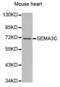 Semaphorin 3C antibody, abx002410, Abbexa, Western Blot image 