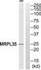 Mitochondrial Ribosomal Protein L35 antibody, TA315465, Origene, Western Blot image 