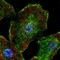 DM1 Locus, WD Repeat Containing antibody, HPA068172, Atlas Antibodies, Immunofluorescence image 