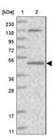 Queuine TRNA-Ribosyltransferase Accessory Subunit 2 antibody, NBP1-83706, Novus Biologicals, Western Blot image 