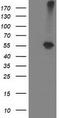 Alcohol Dehydrogenase 1B (Class I), Beta Polypeptide antibody, TA502776S, Origene, Western Blot image 