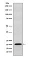 Ras-related protein Rap-1b antibody, M01848, Boster Biological Technology, Western Blot image 